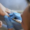 Formation en Pédicurie Médicale : Spécialisation en pédicurie médicale – Image 10